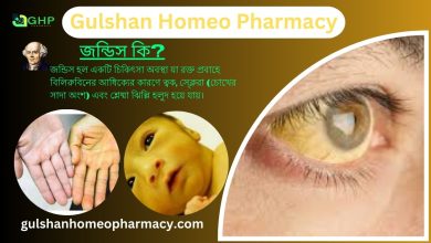 জন্ডিস কি? জন্ডিসের ধরন, জন্ডিসের লক্ষণ, হোমিওপ্যাথি দ্বারা জন্ডিস সমাধান