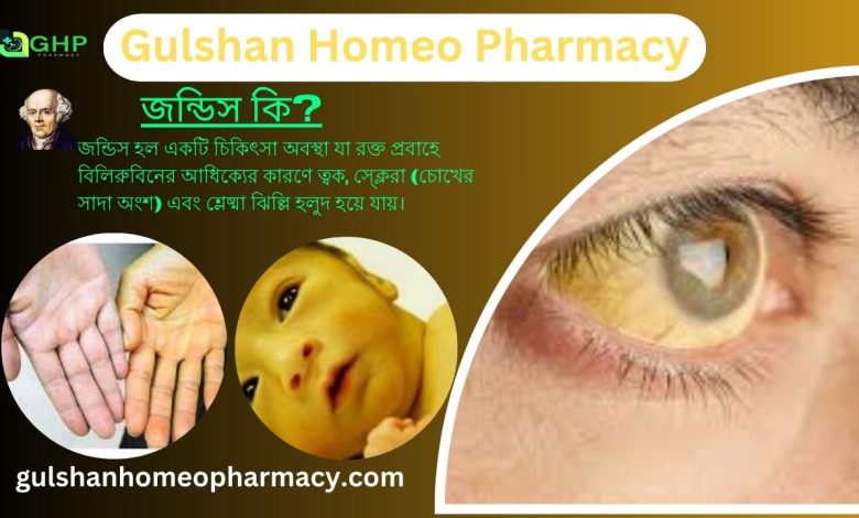 জন্ডিস কি? জন্ডিসের ধরন, জন্ডিসের লক্ষণ, হোমিওপ্যাথি দ্বারা জন্ডিস সমাধান