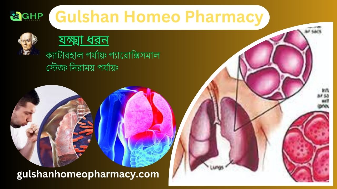 হুপিং কাশি/যক্ষ্মা কি? যক্ষা কেন হয়, যক্ষ্মা ধরন, যক্ষ্মার লক্ষণ, যক্ষ্মা হোমিওপ্যাথি দ্বারা সমাধান।