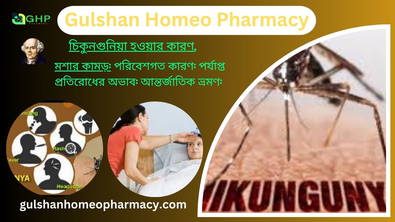 চিকুনগুনিয়া কি?, চিকুনগুনিয়া হওয়ার কারণ, চিকুনগুনিয়ার প্রকার, চিকুনগুনিয়ার লক্ষণ, চিকুনগুনিয়া হোমিওপ্যাথি দ্বারা সমাধান