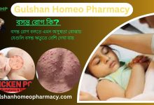 বসন্ত রোগ কি? বসন্ত রোগের ধরন, বসন্ত রোগের উপসর্গ, হোমিওপ্যাথি দ্বারা বসন্ত রোগের সমাধান