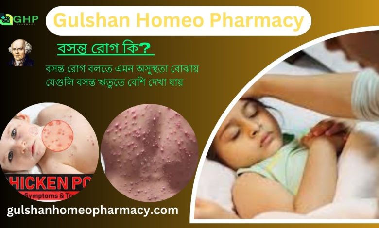 বসন্ত রোগ কি? বসন্ত রোগের ধরন, বসন্ত রোগের উপসর্গ, হোমিওপ্যাথি দ্বারা বসন্ত রোগের সমাধান