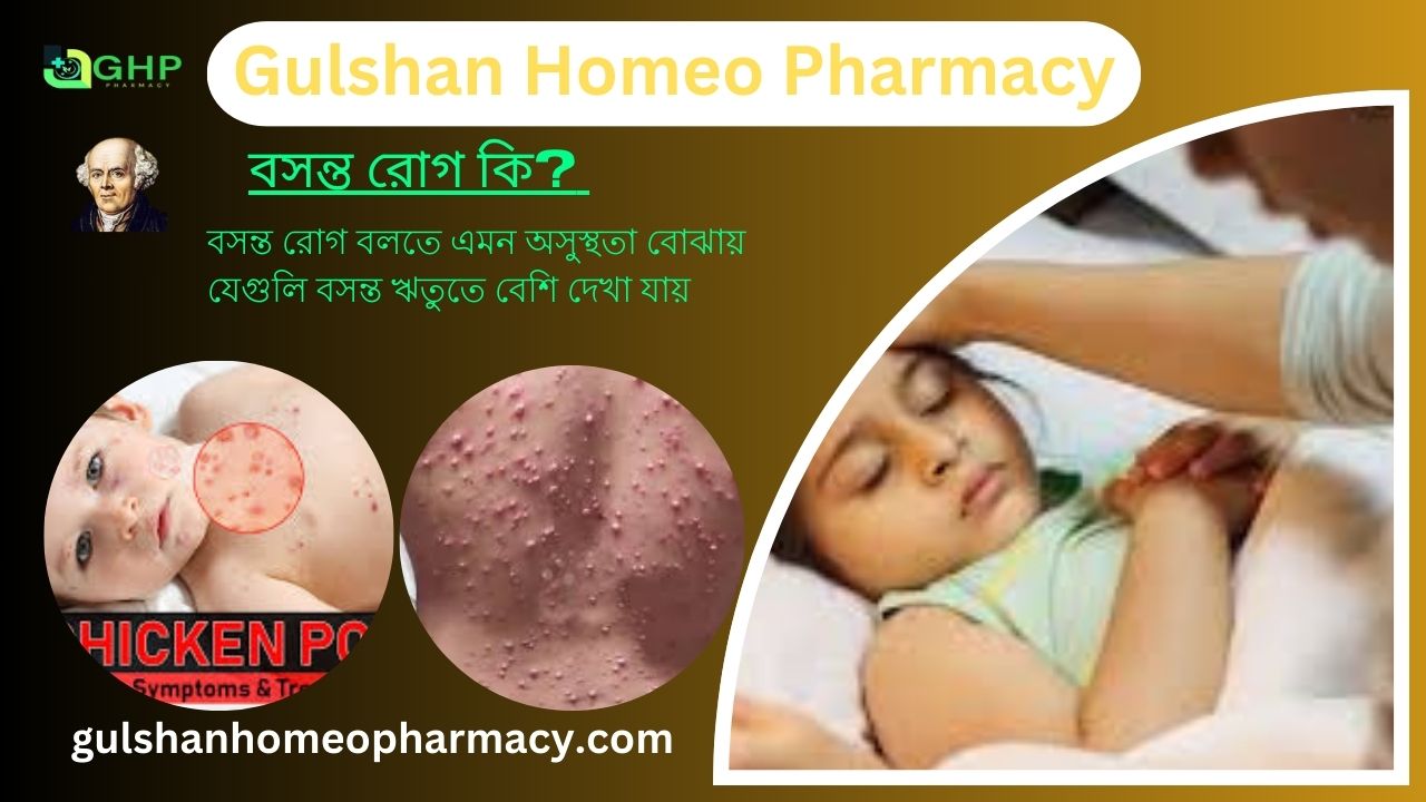 বসন্ত রোগ কি? বসন্ত রোগের ধরন, বসন্ত রোগের উপসর্গ, হোমিওপ্যাথি দ্বারা বসন্ত রোগের সমাধান