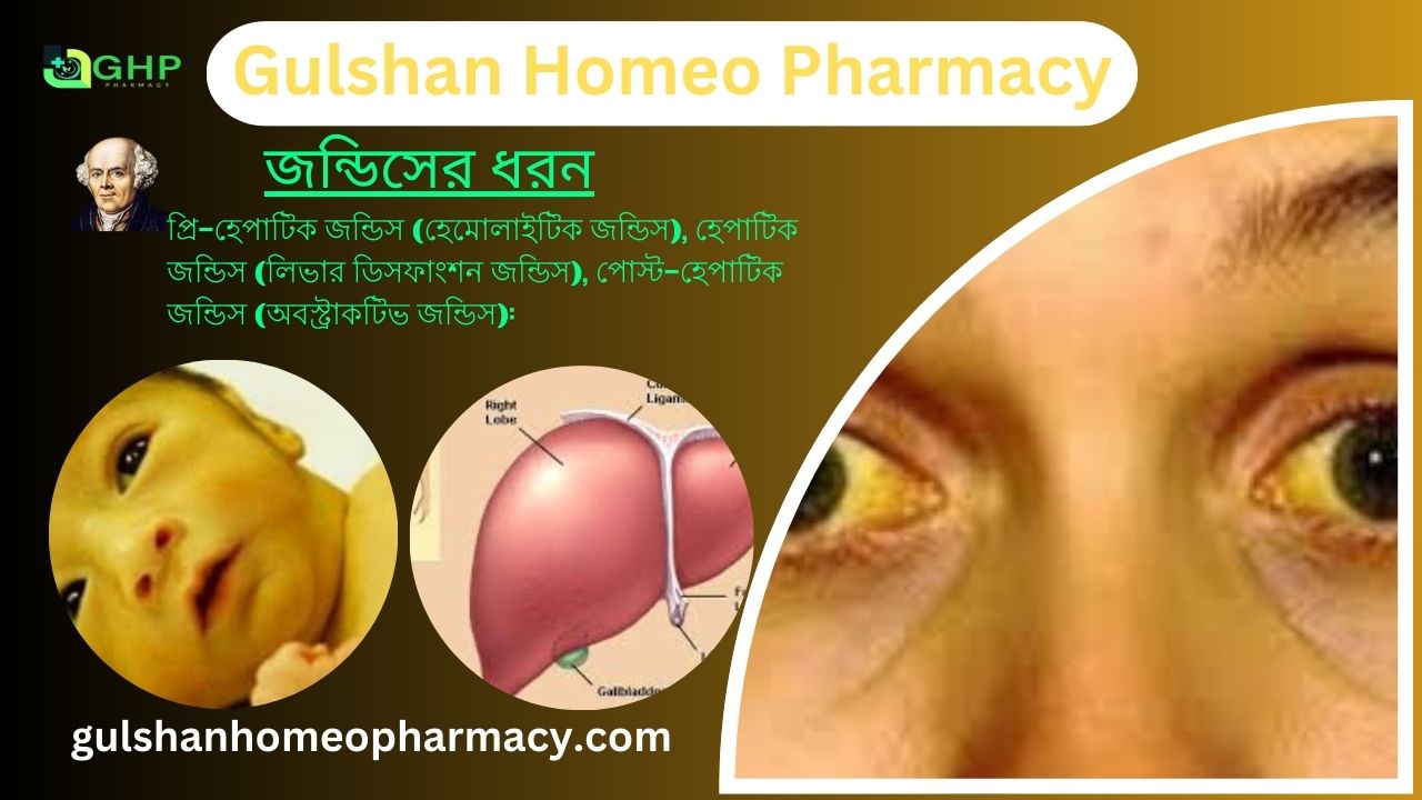 জন্ডিস কি? জন্ডিসের ধরন, জন্ডিসের লক্ষণ, হোমিওপ্যাথি দ্বারা জন্ডিস সমাধান
