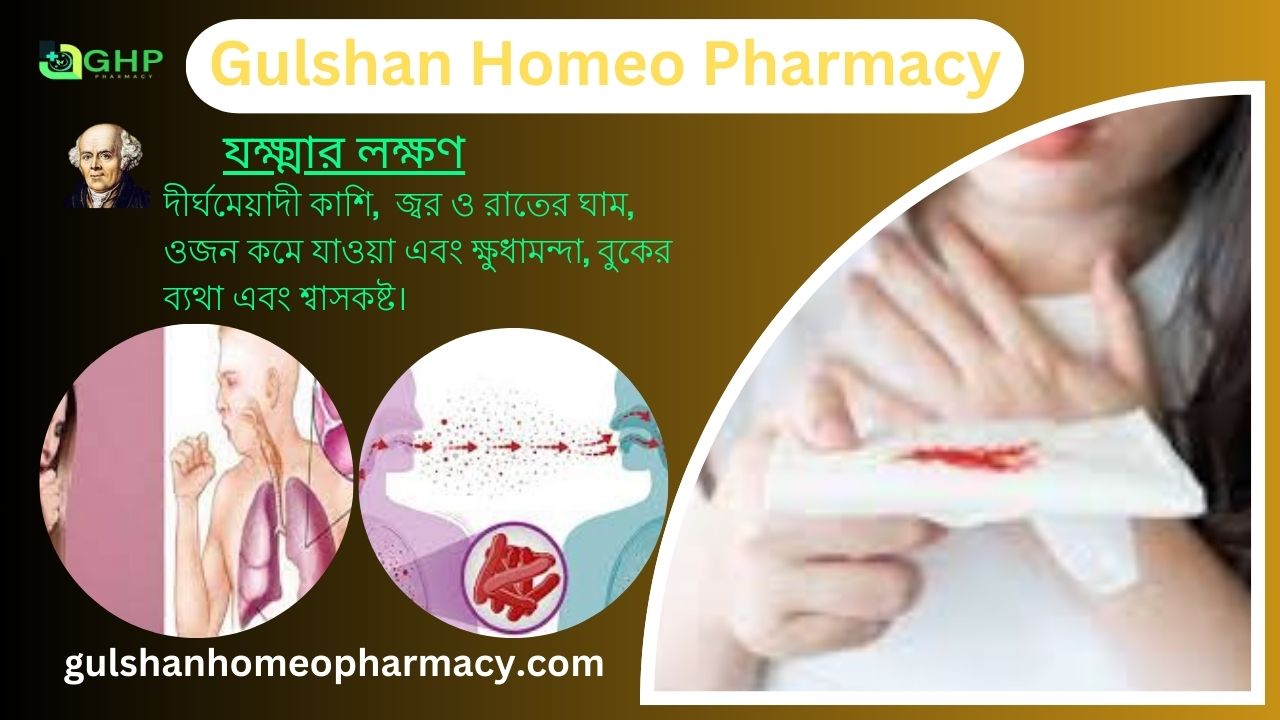 হুপিং কাশি/যক্ষ্মা কি? যক্ষা কেন হয়, যক্ষ্মা ধরন, যক্ষ্মার লক্ষণ, যক্ষ্মা হোমিওপ্যাথি দ্বারা সমাধান।