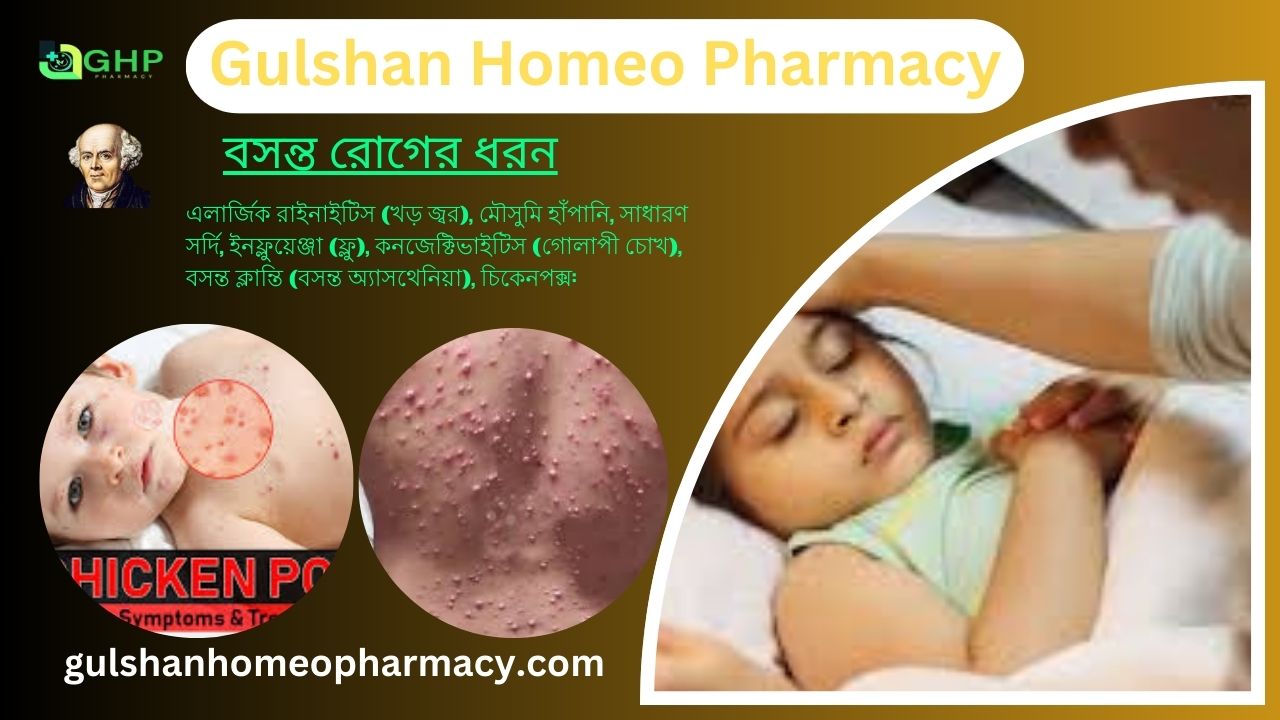 বসন্ত রোগ কি? বসন্ত রোগের ধরন, বসন্ত রোগের উপসর্গ, হোমিওপ্যাথি দ্বারা বসন্ত রোগের সমাধান