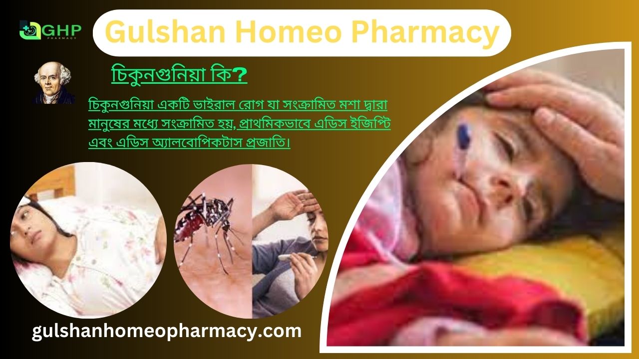 চিকুনগুনিয়া কি?, চিকুনগুনিয়া হওয়ার কারণ, চিকুনগুনিয়ার প্রকার, চিকুনগুনিয়ার লক্ষণ, চিকুনগুনিয়া হোমিওপ্যাথি দ্বারা সমাধান