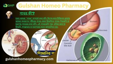 পাথর কী? পাথরি হওয়ার কারণ, পাথরের ধরন, পাথরের লক্ষণ, এবং হোমিওপ্যাথিতে পাথরের সমাধান