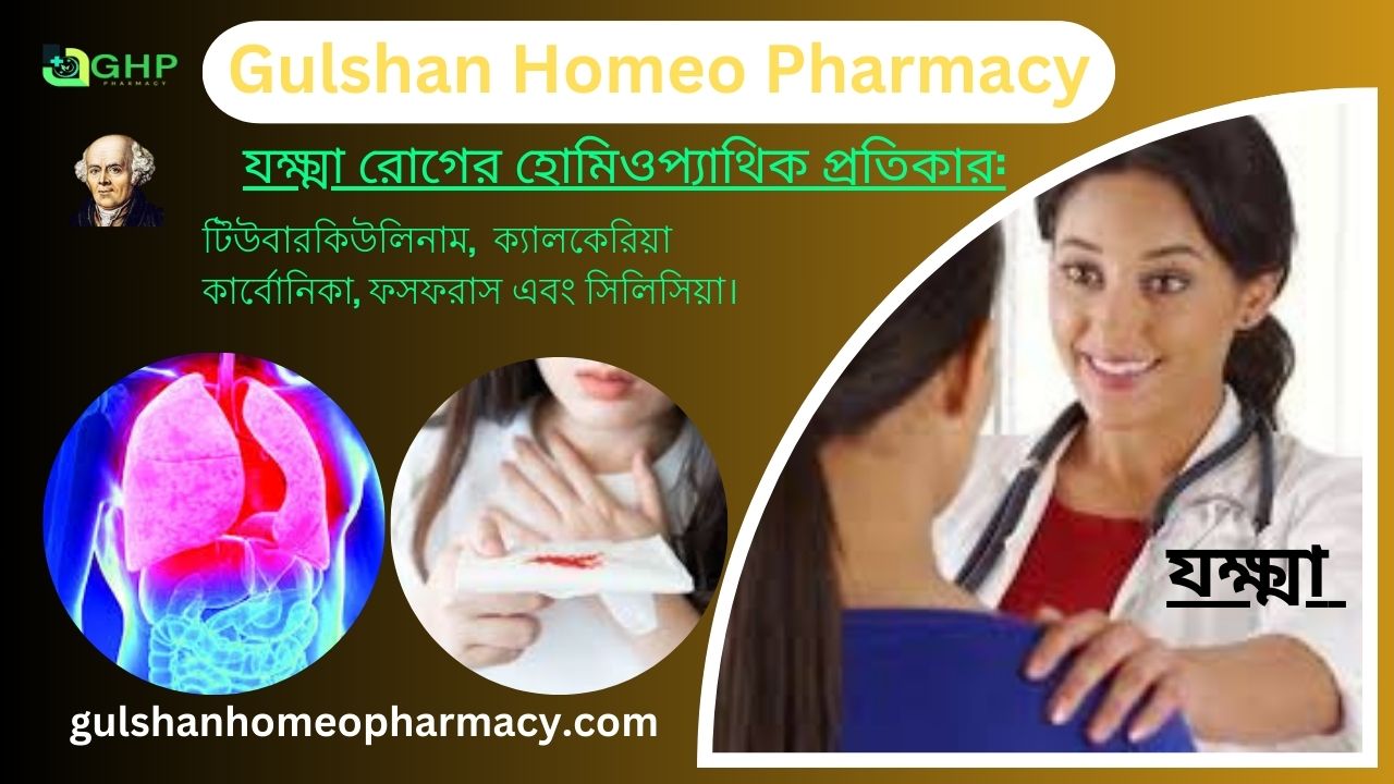 হুপিং কাশি/যক্ষ্মা কি? যক্ষা কেন হয়, যক্ষ্মা ধরন, যক্ষ্মার লক্ষণ, যক্ষ্মা হোমিওপ্যাথি দ্বারা সমাধান।