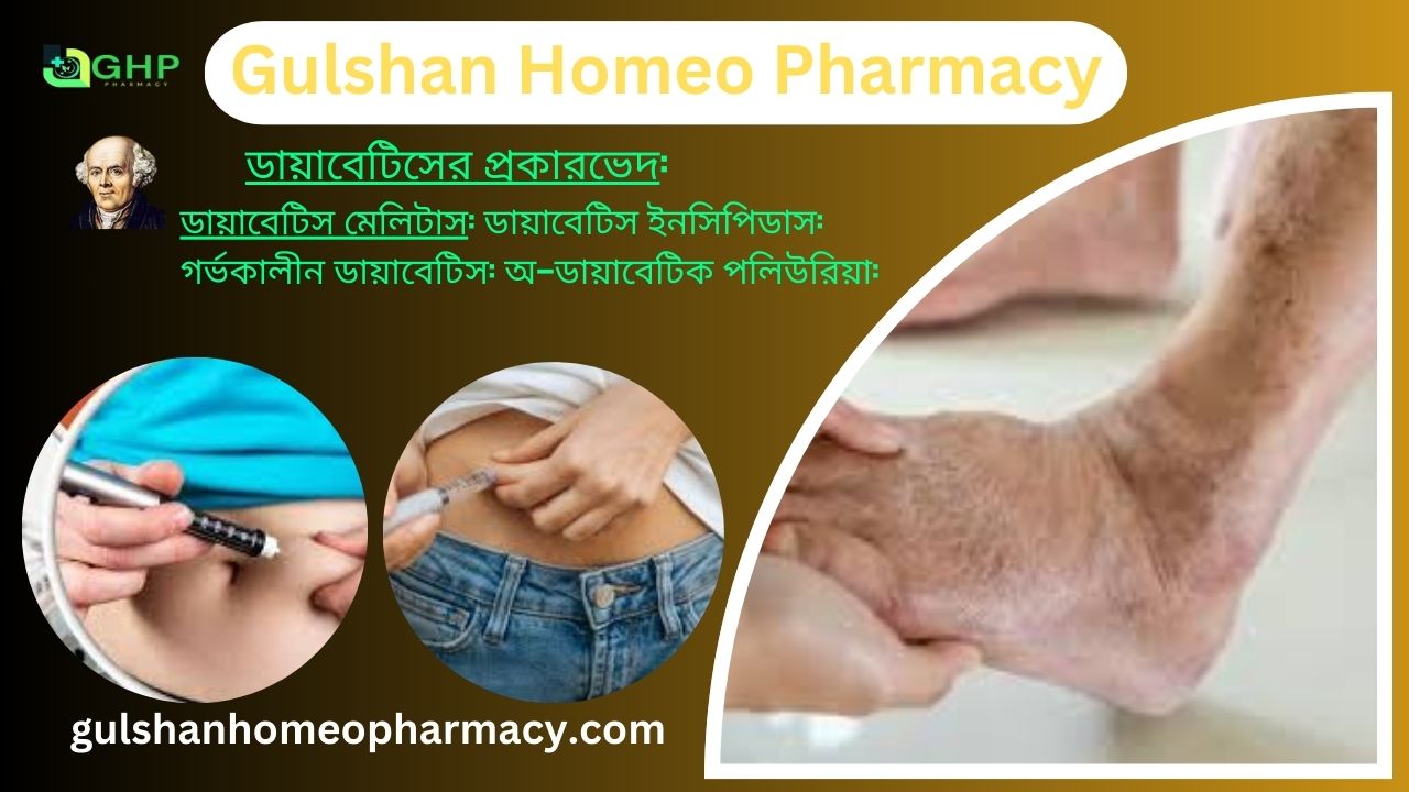 ডায়াবেটিস কি?, ডায়াবেটিস হওয়ার কারণ, ডায়াবেটিসের প্রকারভেদ, ডায়াবেটিসের লক্ষণ, ডায়াবেটিস প্রাকৃতিক উপায়ে সমাধান, ডায়াবেটিস হোমিওপ্যাথি দ্বারা সমাধান।