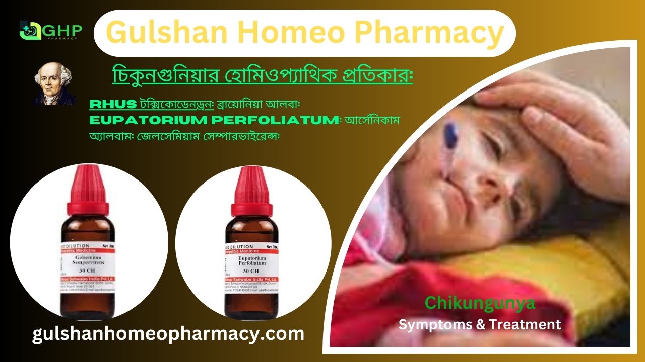 চিকুনগুনিয়া কি?, চিকুনগুনিয়া হওয়ার কারণ, চিকুনগুনিয়ার প্রকার, চিকুনগুনিয়ার লক্ষণ, চিকুনগুনিয়া হোমিওপ্যাথি দ্বারা সমাধান