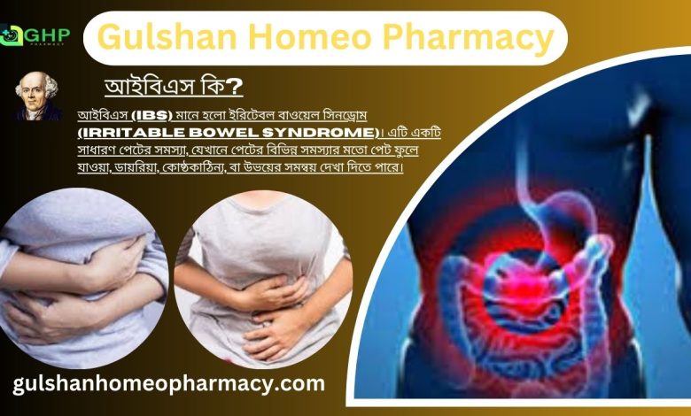 আইবিএস কি?, আইবিএস হওয়ার কারণ, আইবিএস এর ধরন, আই বি এস এর লক্ষণ, হোমিওপ্যাথিতে আইবিএস এর চিকিৎসা