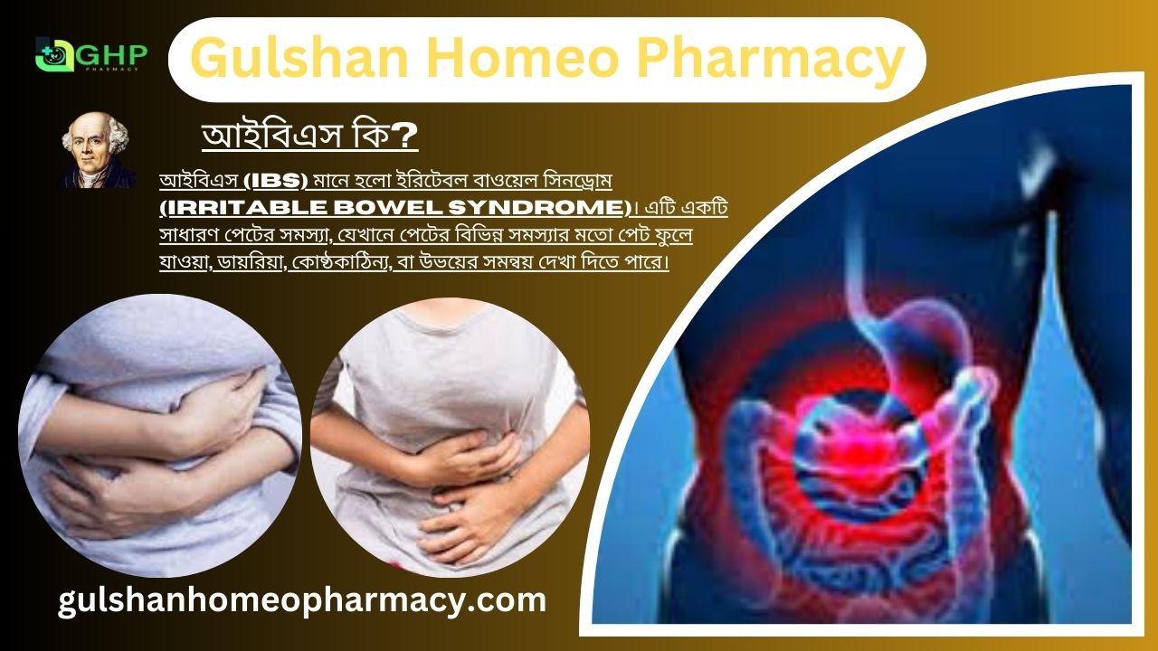 আইবিএস কি?, আইবিএস হওয়ার কারণ, আইবিএস এর ধরন, আই বি এস এর লক্ষণ, হোমিওপ্যাথিতে আইবিএস এর চিকিৎসা