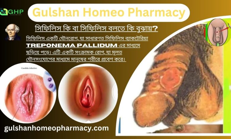 সিফিলিস কি বা সিফিলিস বলতে কি বুঝায়?, সিফিলিস হওয়ার কারণ, সিফিলিসের ধরন, সিফিলিসের লক্ষণ, সিফিলিসের হোমিওপ্যাথিতে চিকিৎসা