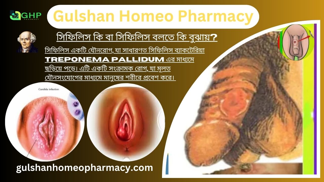 সিফিলিস কি বা সিফিলিস বলতে কি বুঝায়?, সিফিলিস হওয়ার কারণ, সিফিলিসের ধরন, সিফিলিসের লক্ষণ, সিফিলিসের হোমিওপ্যাথিতে চিকিৎসা