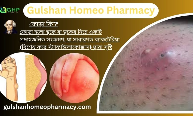 ফোড়া কি?, ফোড়া হওয়ার কারণ, ফোড়ার ধরন, ফোড়ার লক্ষণ, হোমিওপ্যাথিতে ফোড়ার চিকিৎসা