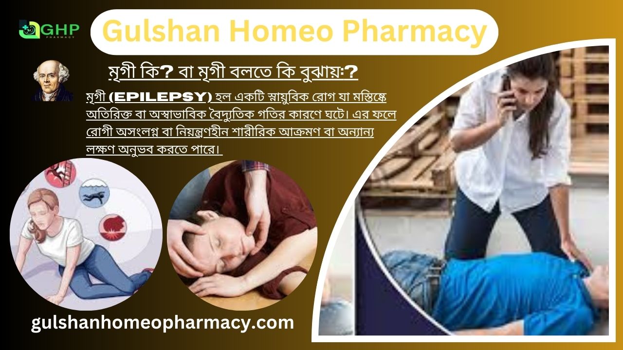 মৃগী কি বা মৃগী বলতে কি বুঝায়, মৃগী কেন হয়, মৃগীর ধরন, মৃগীর লক্ষণ, হোমিওপ্যাথিতে মৃগীর চিকিৎসা